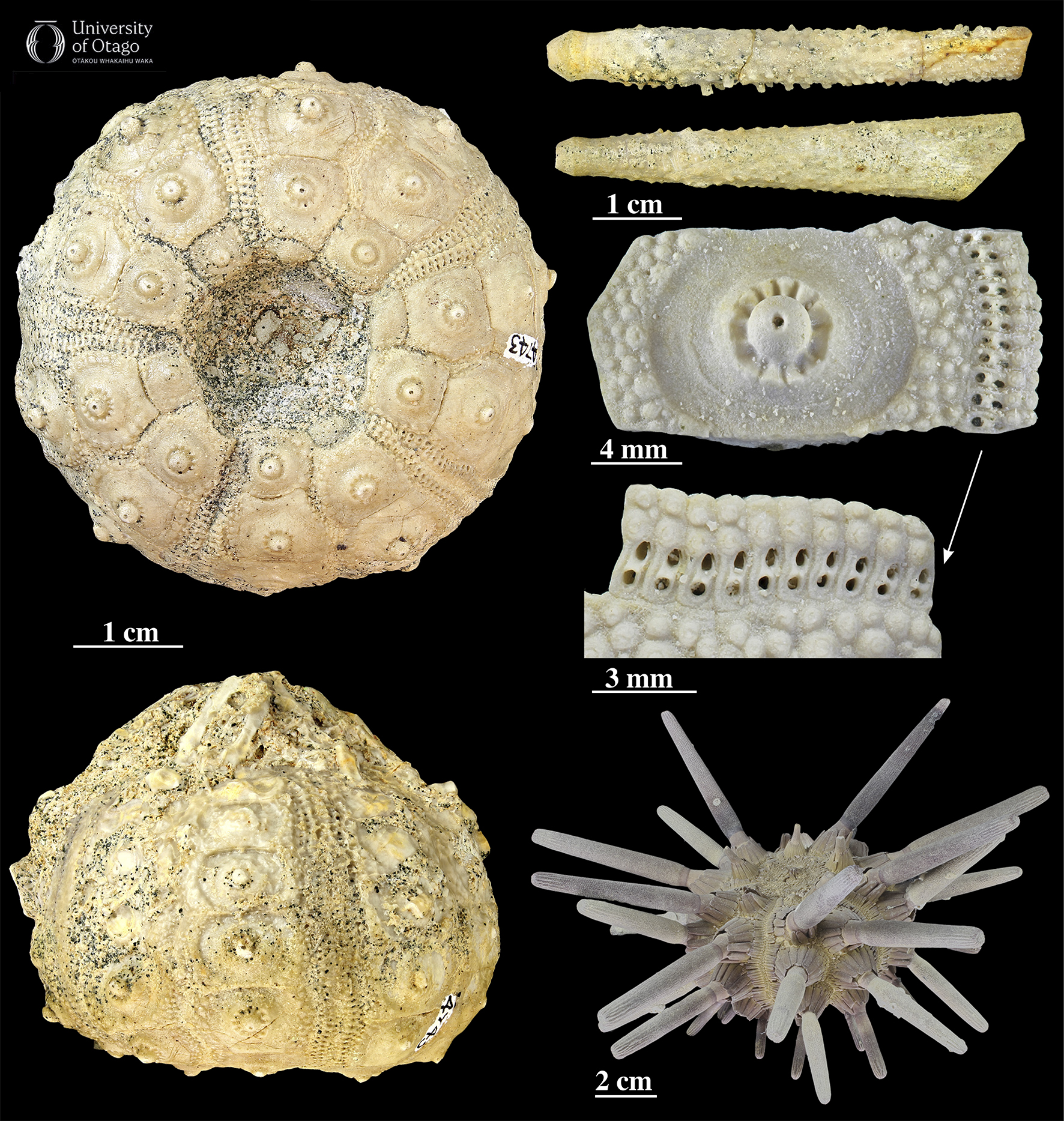The figure shows seven different images of parts of a pencil urchin, which is a type of sea urchin. Six of the images show the pencil urchin Histocidaris mckayi. The images on the left show two views of the outer shell of Histocidaris mckayi. The outer shell of a sea urchin is also called a test. This test is from the holotype for Histocidaris mckayi which has the specimen ID number OU 4743. The test is made up of multiple plates. The top right and middle right images show spines and a plate from Histocidaris mckayi. The plate has a large central tubercle (bump) where a spine would have attached when the animal was alive. The smooth ring around the central tubercle in the plate is where the muscles that moved the spine would have attached. The plate also has smaller tubercles where other, smaller spines would have attached. The double row of holes or pores in the plate are where tiny tube feet would have emerged. The image in the lower right is a test from a modern pencil urchin that is possibly from the genus Prionocidaris. The modern urchin shows what Histocidaris mckayi would have looked like before it lost all of its spines.