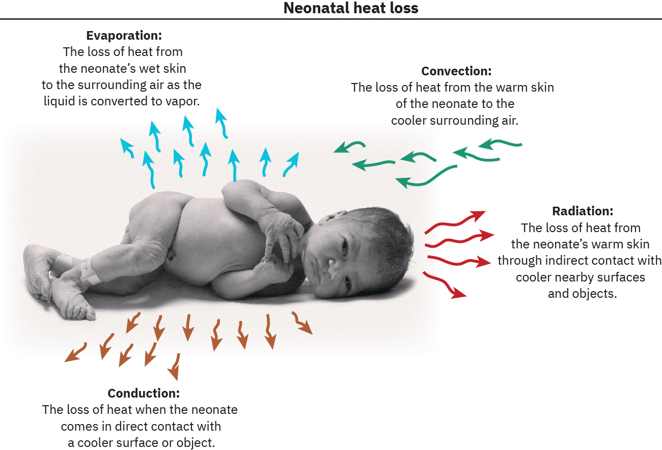 Neonates lose heat by evaporation, convection, radiation and conduction.