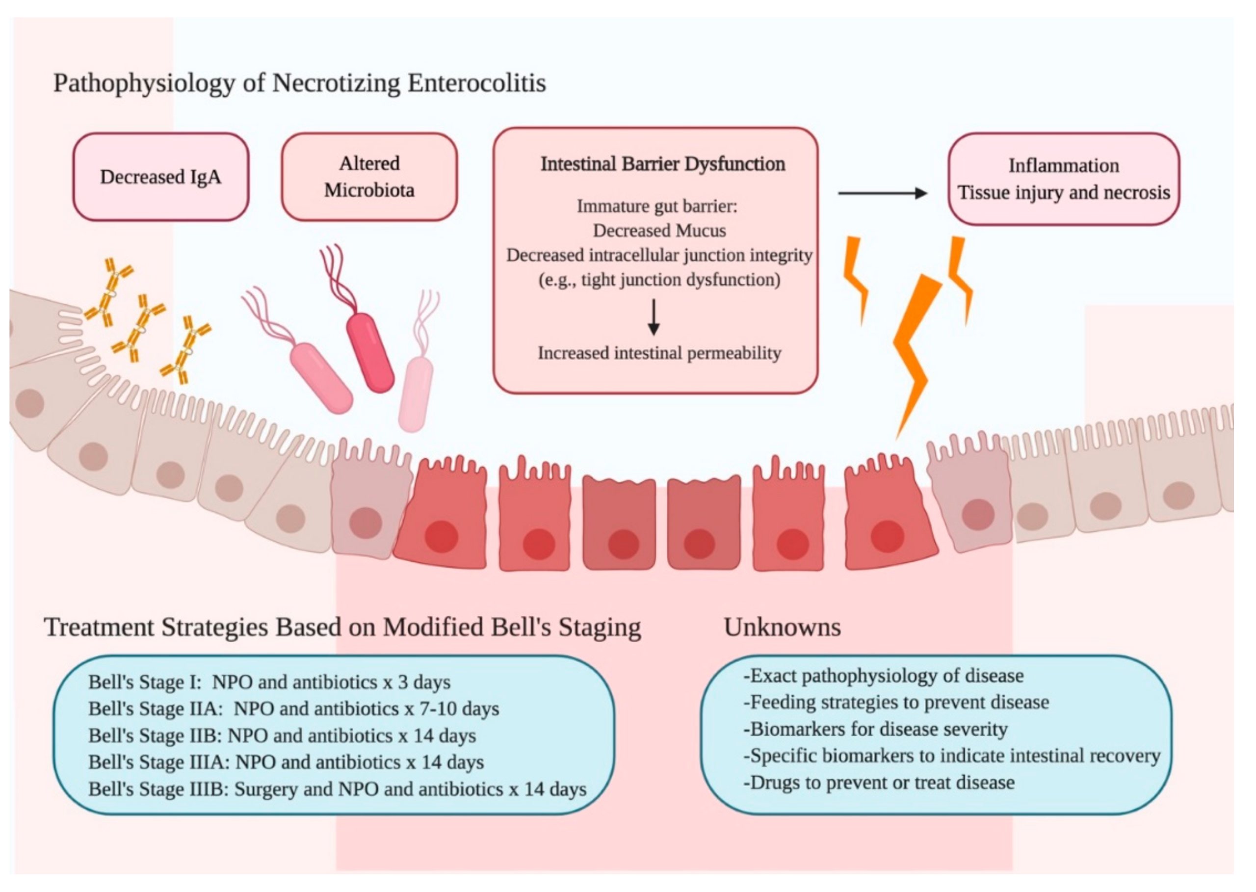 Diagram of Summary of the Pathophysiology, Treatment Strategies, and Unknowns of Necrotizing Enterocolitis