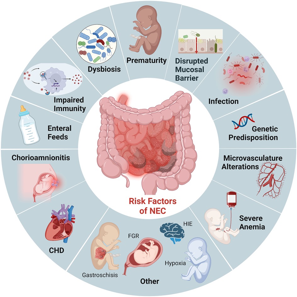 Diagram of the risk factor of NEC including prematurity, enteral feeds, infection, CHD.