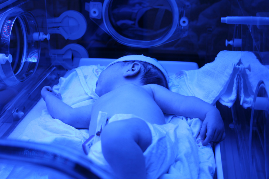 Jaundiced Newborn Receiving Treatment under a Bili Light.