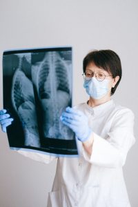 Doctor looking at a chest x-ray