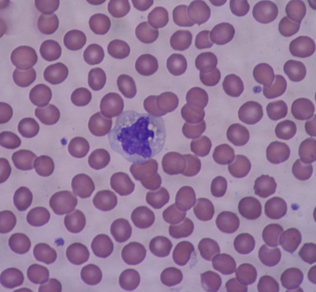 A micrograph showing whole blood on a microscope slide. A single large monocyte is visible surrounded by many erythrocytes.