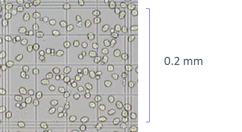 An actual micrograph showing one of the outer corner squares from a haemocytometer containing purified human platelets.