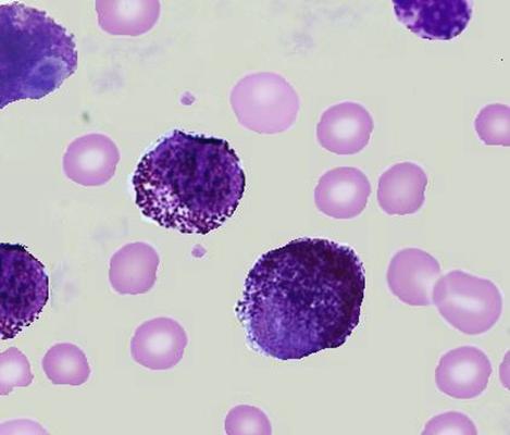 A photomicrograph of an unknown leukocyte showing a lot of granulation. The leukocyte is around twice the diameter of neighbouring erythrocytes.