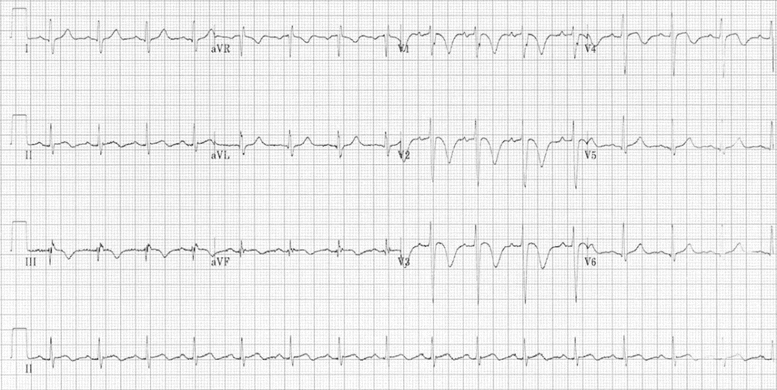 Facsimile of an ECG printout