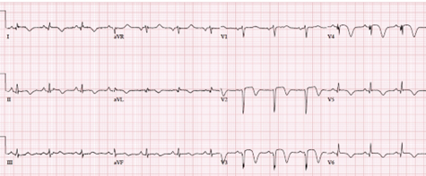 Facsimile of an ECG printout