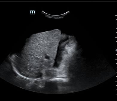 Abdominal scan