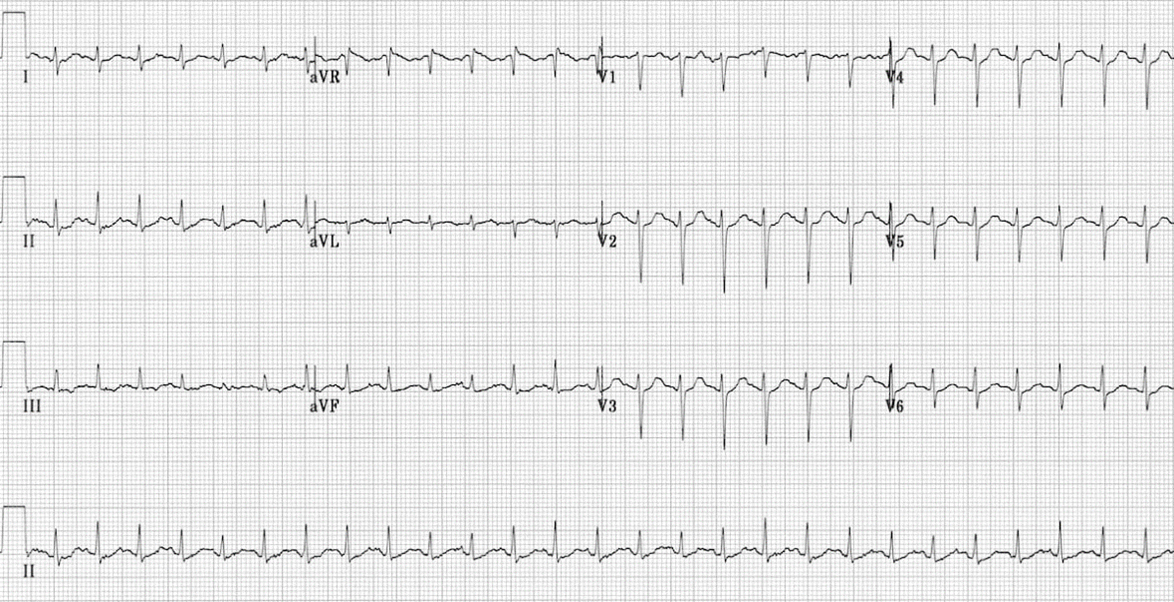 Facsimile of an ECG printout